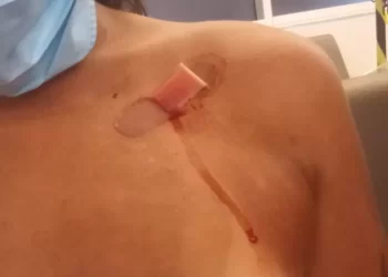 Empregada doméstica é vítima de tentativa de homicídio em Machadinho do Oeste