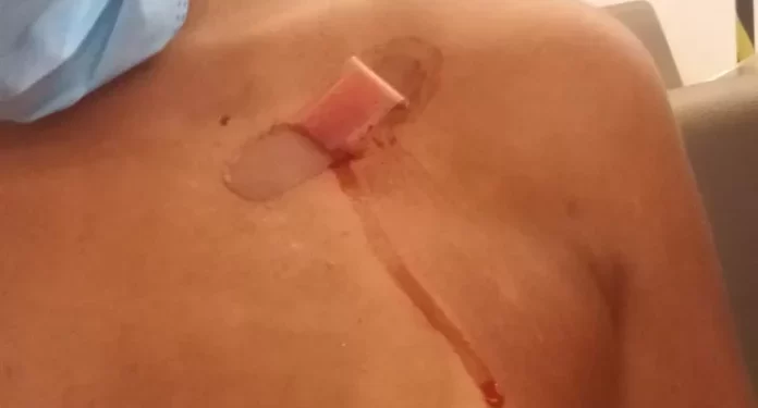 Empregada doméstica é vítima de tentativa de homicídio em Machadinho do Oeste