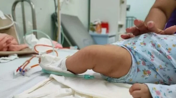 Casos de SRAG crescem em crianças menores de 2 anos